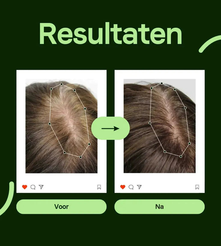 Scandinavian Biolabs Bio-Pilixin serum (vrouw) - Hairgivers
