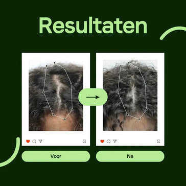 Scandinavian Biolabs Bio-Pilixin shampoo + conditioner vrouw (250 ml) Scandinavian Biolabs Bio-Pilixin shampoo + conditioner vrouw (250 ml) - Hairgivers