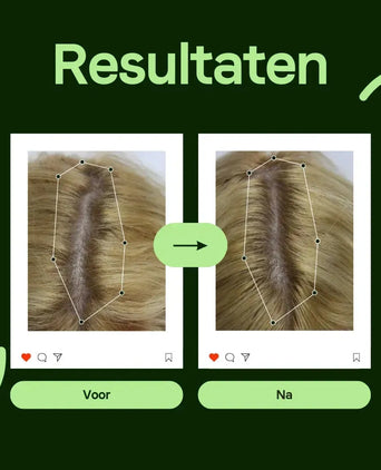Scandinavian Biolabs Bio-Pilixin shampoo vrouw (250 ml) Scandinavian Biolabs Bio-Pilixin shampoo vrouw (250 ml) - Hairgivers