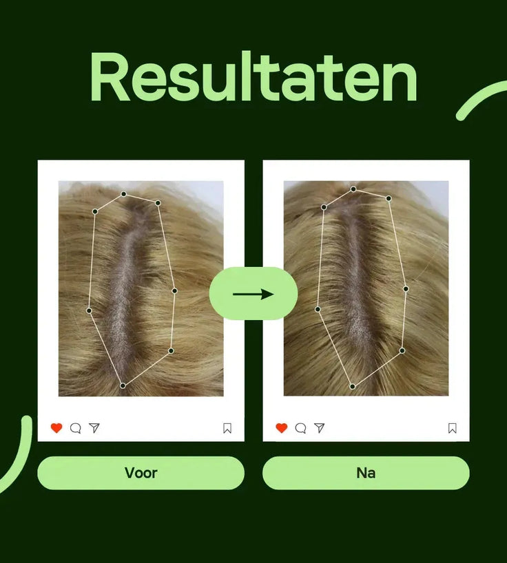 Scandinavian Biolabs Bio-Pilixin shampoo vrouw (250 ml) - Hairgivers