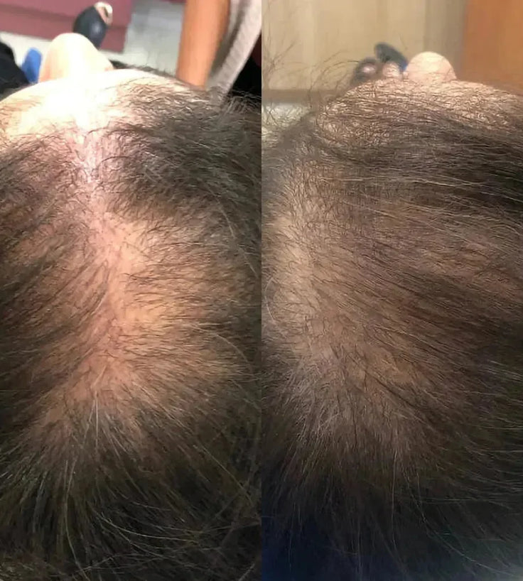 Spectral.CSF (Adenosine) lotion - Hairgivers