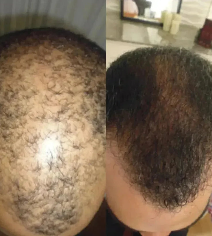 Spectral.DNC-N (Nanoxidil) lotion - Hairgivers