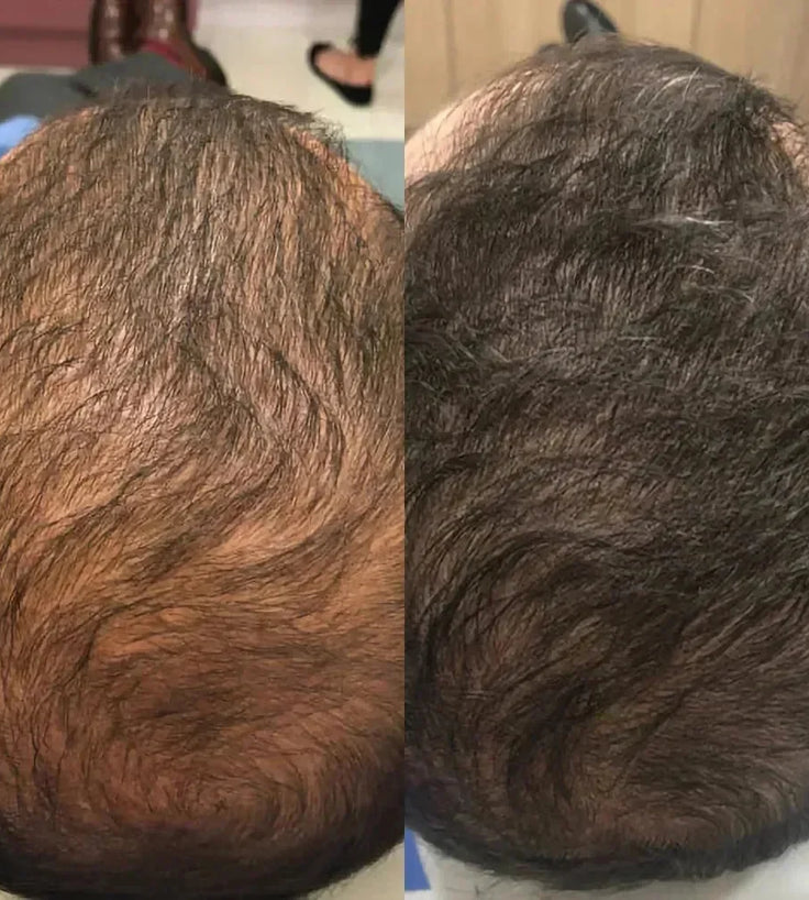 Spectral.DNC-N (Nanoxidil) lotion - Hairgivers