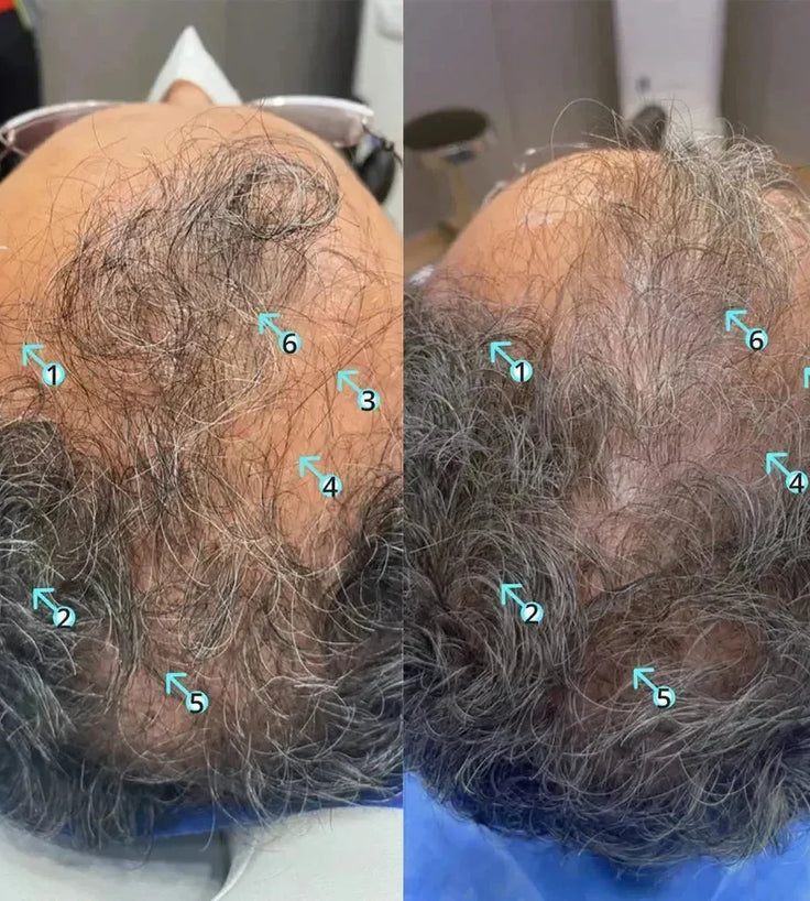 Spectral.DNC-S (Melanex) lotion - Hairgivers