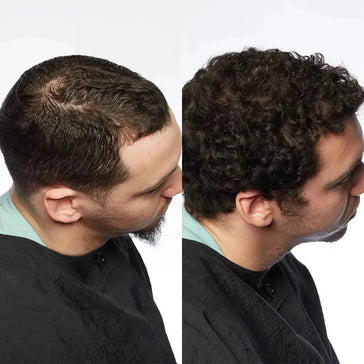 Theradome LH80 PRO laserhelm Theradome LH80 PRO laserhelm - Hairgivers