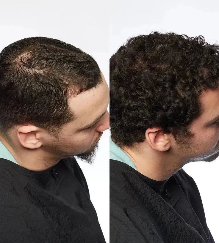 Theradome LH80 PRO laserhelm - Hairgivers