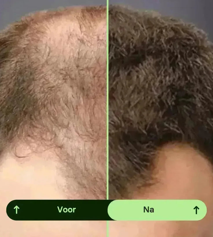 Toppik hair thickener kleurenspray - Hairgivers