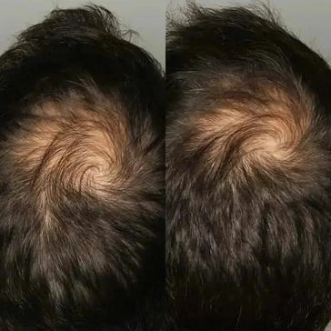 Viviscal hair growth supplement voor mannen (3 mnd) Viviscal hair growth supplement voor mannen (3 mnd) - Hairgivers