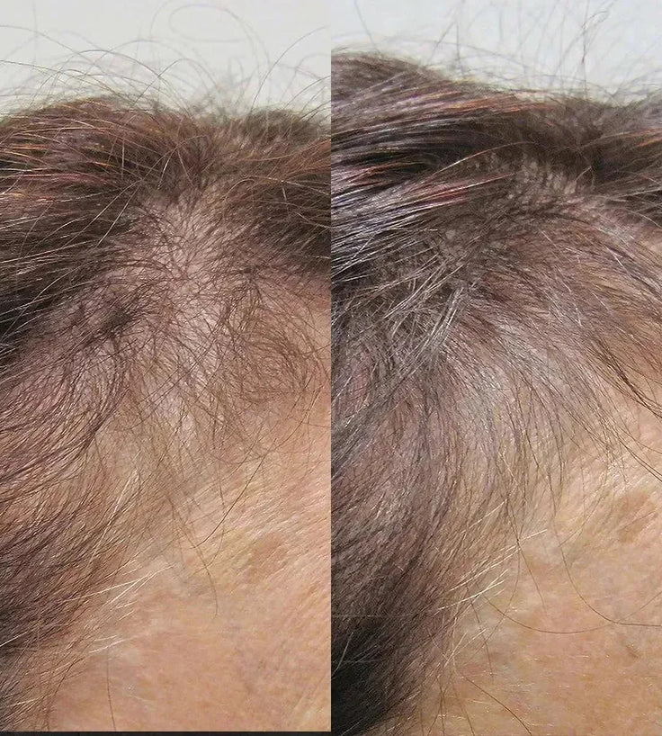 Viviscal hair growth supplement voor vrouwen (1 mnd) - Hairgivers