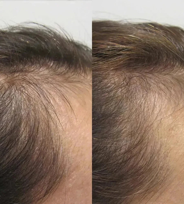 Viviscal hair growth supplement voor vrouwen (1 mnd) - Hairgivers