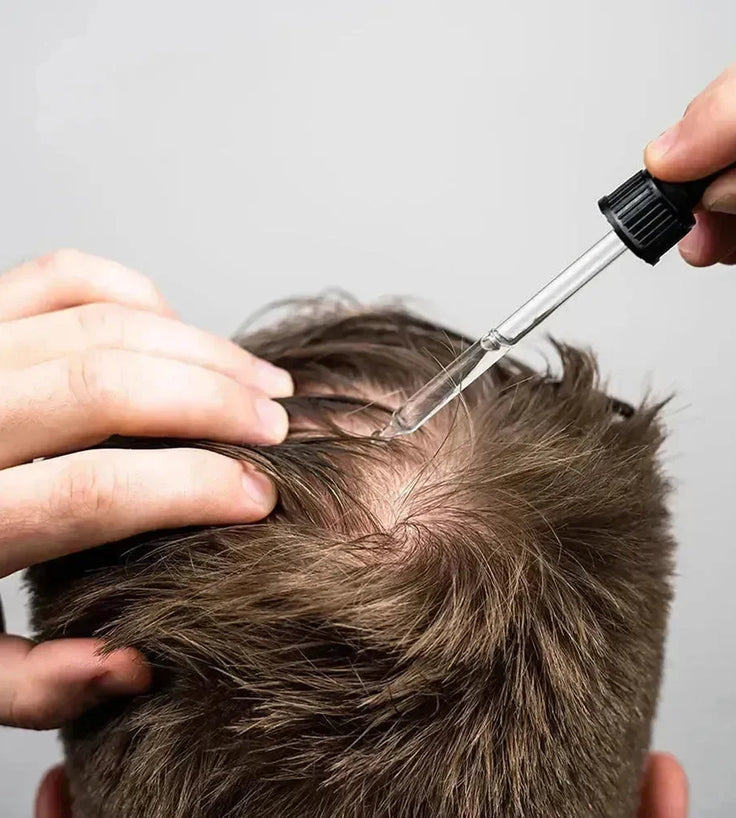 Scandinavian Biolabs Bio-Pilixin serum (man) - Hairgivers