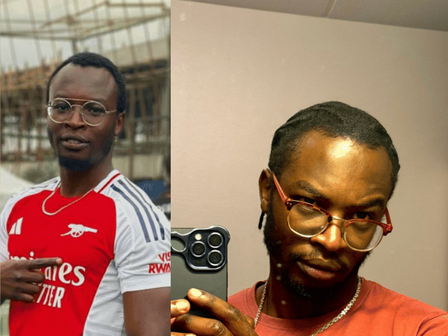 Het verhaal van Clifton: Echte resultaten met minoxidil