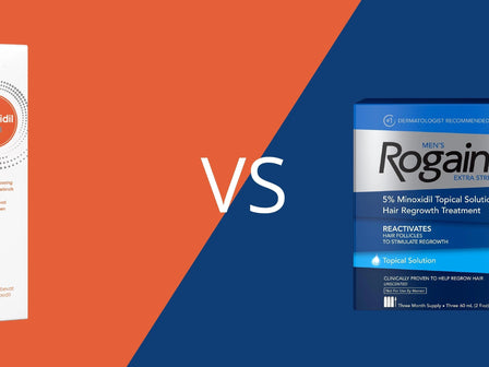 Rogaine versus Linn Minoxidil