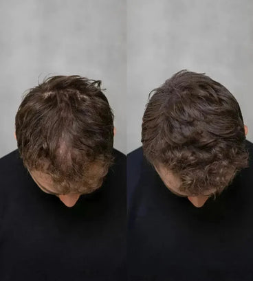 3x Keratain haarvezels + gratis Keratain pommade - Lichtbruin (25 gr) - Hairgivers