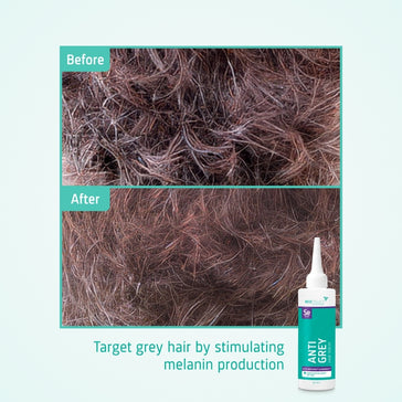 Neofollics anti-grey serum - Hairgivers