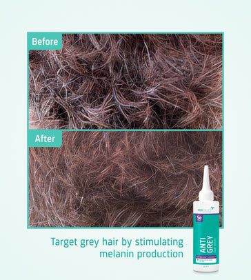 Neofollics Anti Grey Hair Serum Neofollics anti-grey serum - Hairgivers