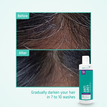 Neofollics Anti Grey Hair Shampoo