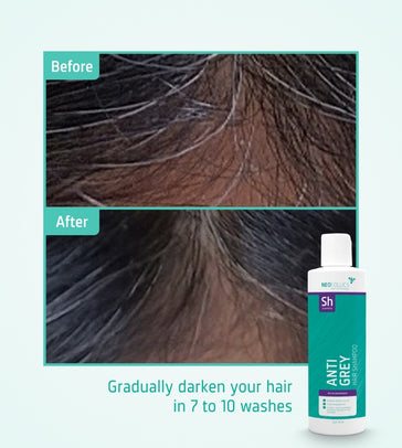 Neofollics Anti Grey Hair Shampoo
