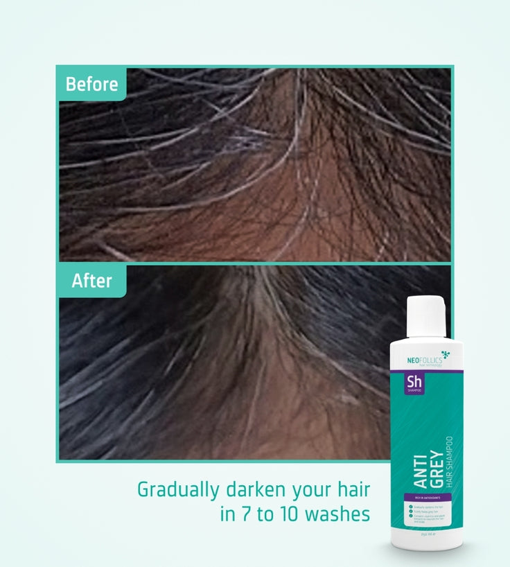 Neofollics Anti Grey Hair Shampoo