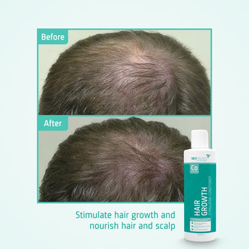 Neofollics conditioner (250 ml) - Hairgivers