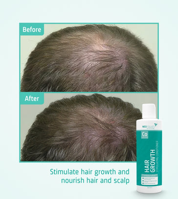 Neofollics Conditioner (250 ml) Neofollics conditioner (250 ml) - Hairgivers