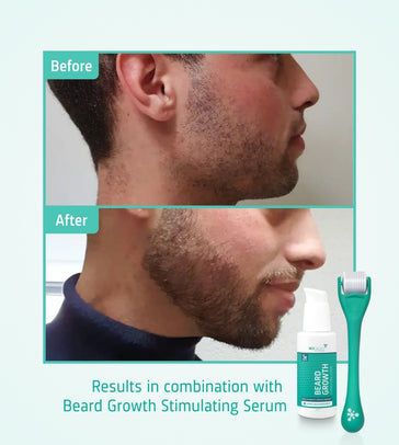 4x Neofollics baardgroei serum + gratis baardroller - Hairgivers