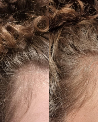 Golden Effect Serum + Mask + Scrub (droge hoofdhuid)