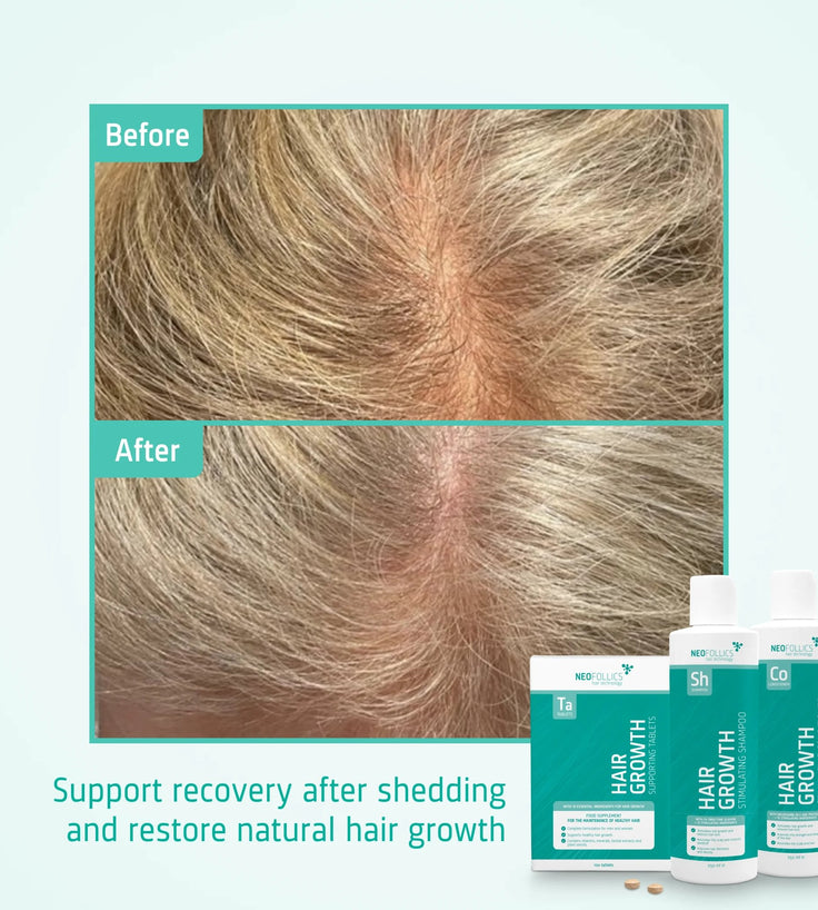 Neofollics Tablets + Shampoo + Conditioner