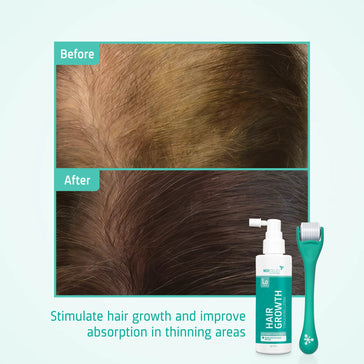 Neofollics lotion + scalp roller - Hairgivers