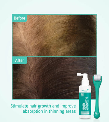 Neofollics Lotion + Scalp Roller Neofollics lotion + scalp roller - Hairgivers