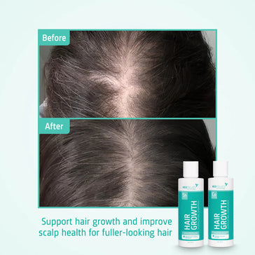 Neofollics haargroei shampoo + conditioner starter kit - Hairgivers