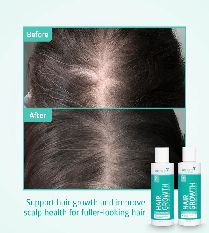 Neofollics Shampoo + Conditioner Starter Kit