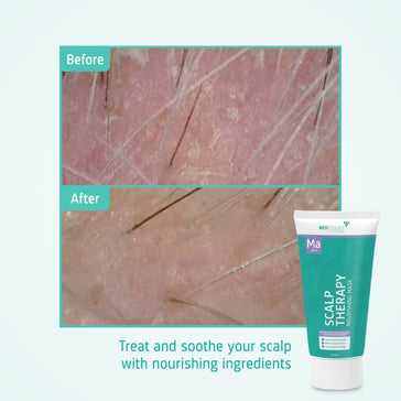 Neofollics nourishing mask - Hairgivers