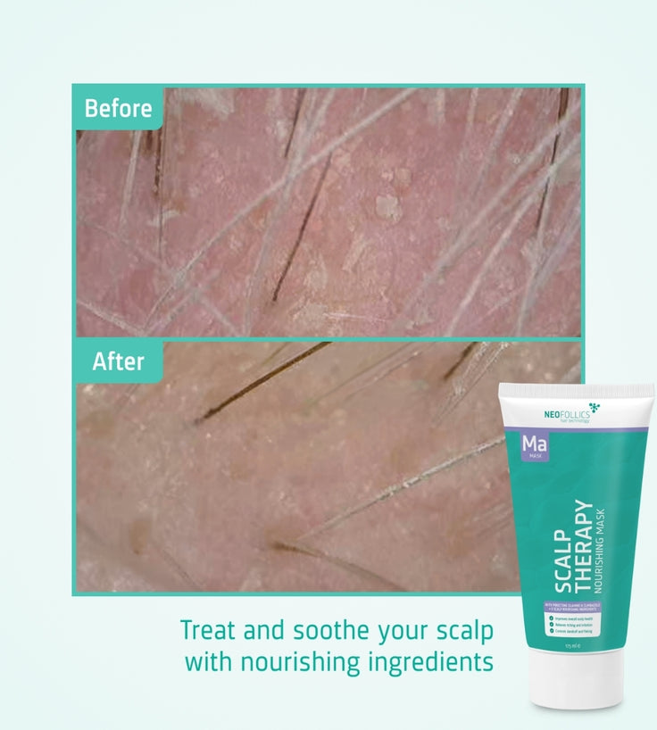 Neofollics Scalp Therapy Nourishing Mask