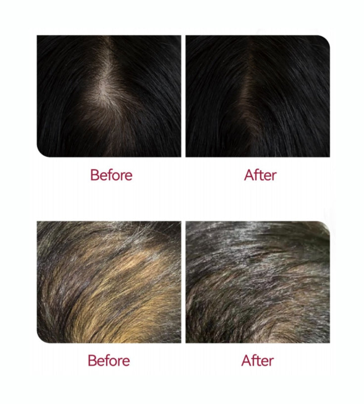 Beaver Anti-Hair Loss Shampoo + Serum + Applicator