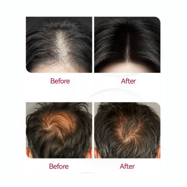 Beaver Anti-Hair Loss Shampoo + Serum + Applicator