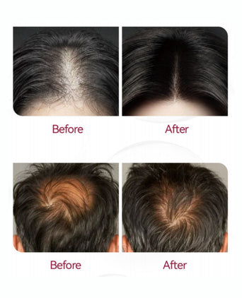 Beaver Anti-Hair Loss Shampoo