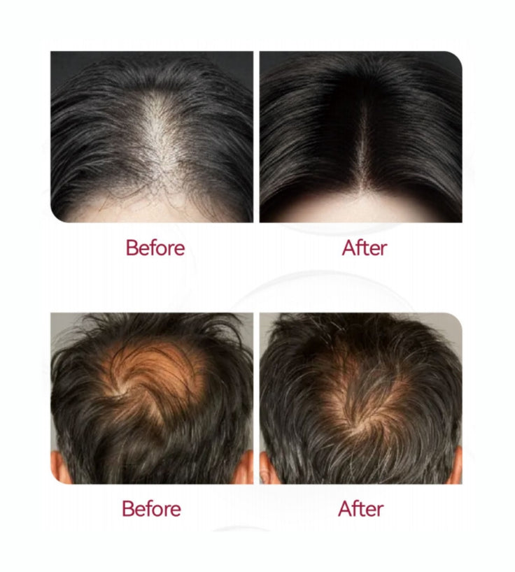 Beaver Anti-Hair Loss Shampoo + Serum + Applicator