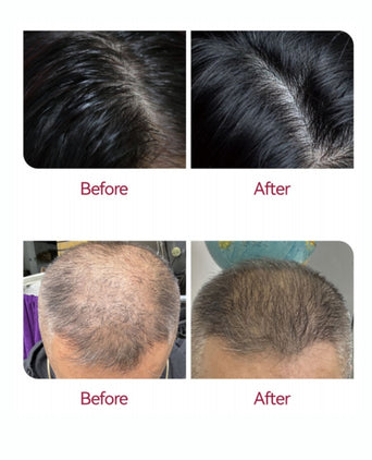 Beaver Anti-Hair Loss Shampoo + Serum + Applicator