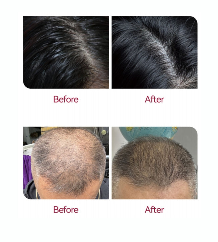Beaver Anti-Hair Loss Shampoo + Serum + Applicator