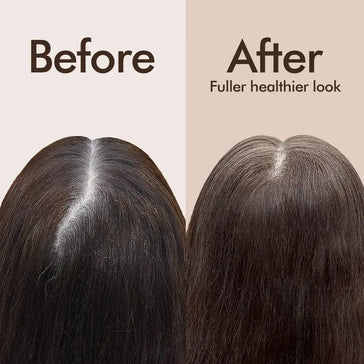 Beaver Biotin & Caffeine thickening scalp behandeling - Hairgivers