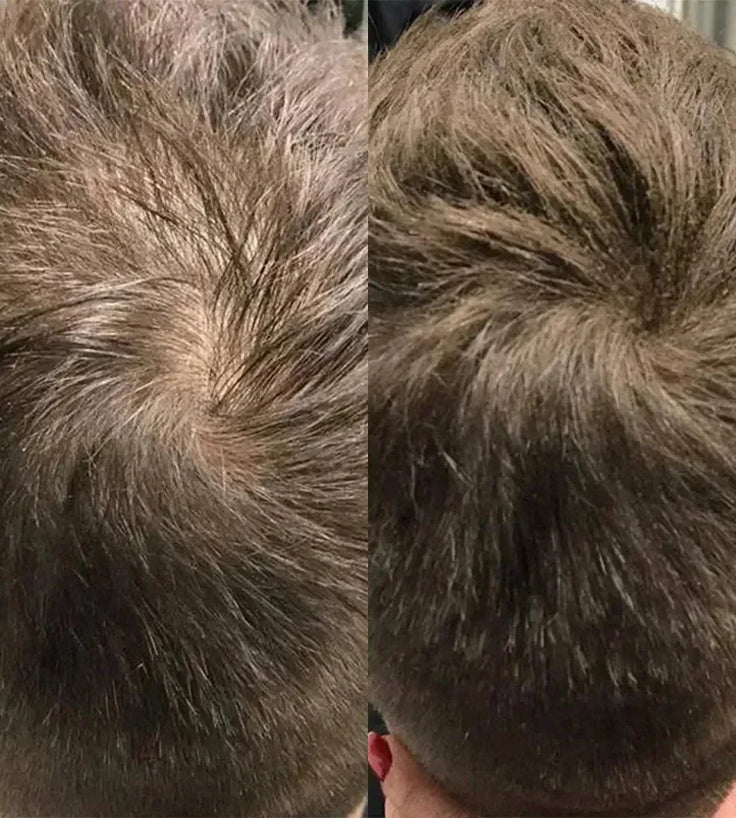 Beaver keratine haarvezels - Lichtbruin (28 gr) - Hairgivers