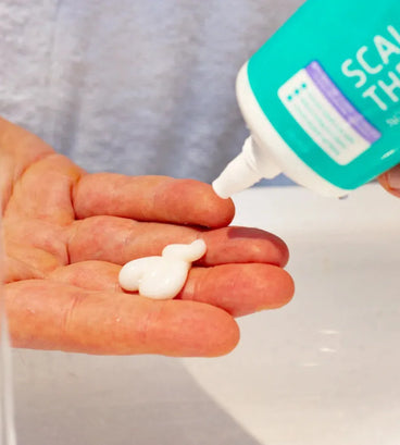 Behandeling seborroïsch eczeem hoofdhuid - Hairgivers