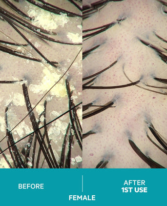 Dandrene anti-roos shampoo