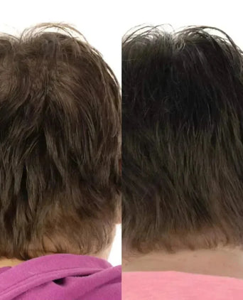 Foligain haaruitval shampoo + conditioner vrouw (236 ml) - Hairgivers
