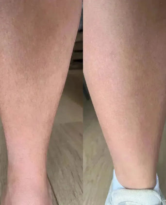 Keramene body hair minimizer ontharingscrème - Hairgivers