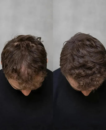 Keratain pommade + Keratain haarvezels - Hairgivers
