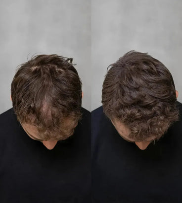 Keratain pommade + Keratain haarvezels - Lichtbruin (25 gr) - Hairgivers
