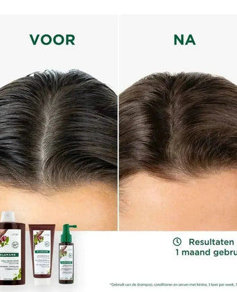 Klorane anti-haaruitval behandeling - Hairgivers