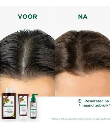 Klorane anti-haaruitval behandeling - Hairgivers